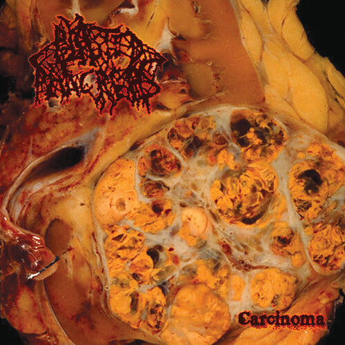 Blasted Pancreas: Carcinoma - VINYL